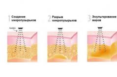Лечение целлюлита ультразвуком отзывы Ультразвуковая кавитация от целлюлита, способ проведения
