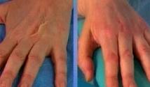 Как можно избежать старения кожи рук